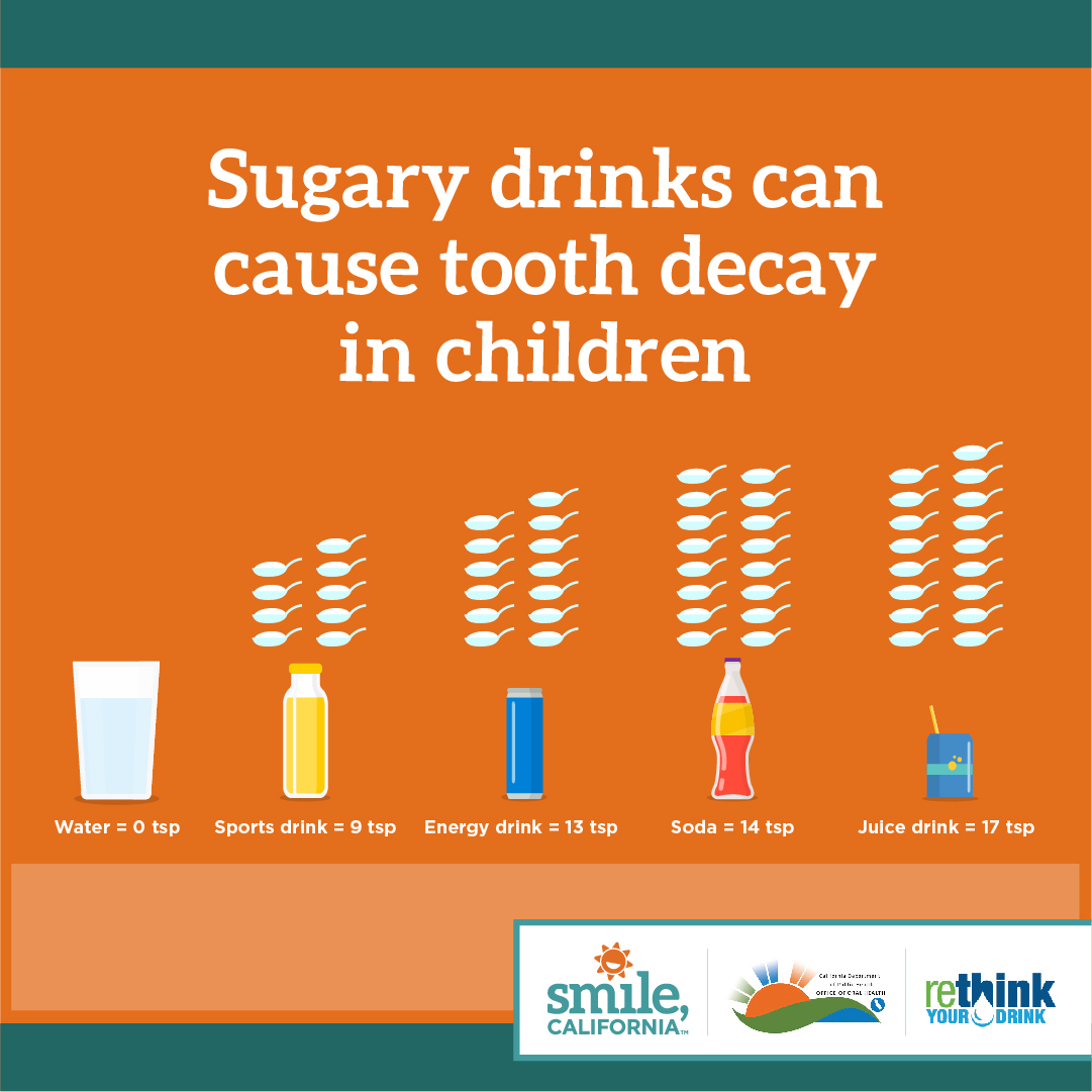 Sugary drinks can cause tooth decay in children
